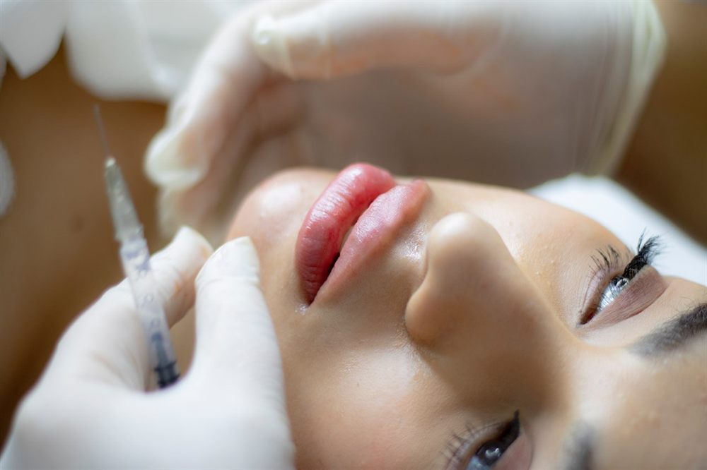 Dermal filler treatment being performed on a patient's cheek at a Cutler Bay aesthetic clinic